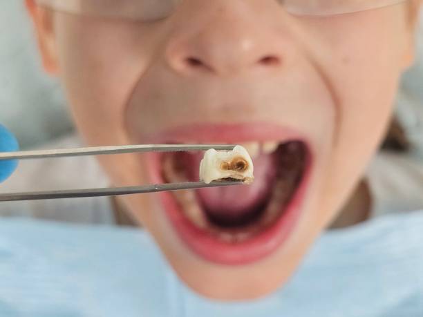 Best Emergency Cosmetic Dentistry in Cavalier, ND
